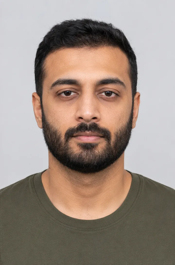 Beard transplant in Istanbul — patient photo after treatment