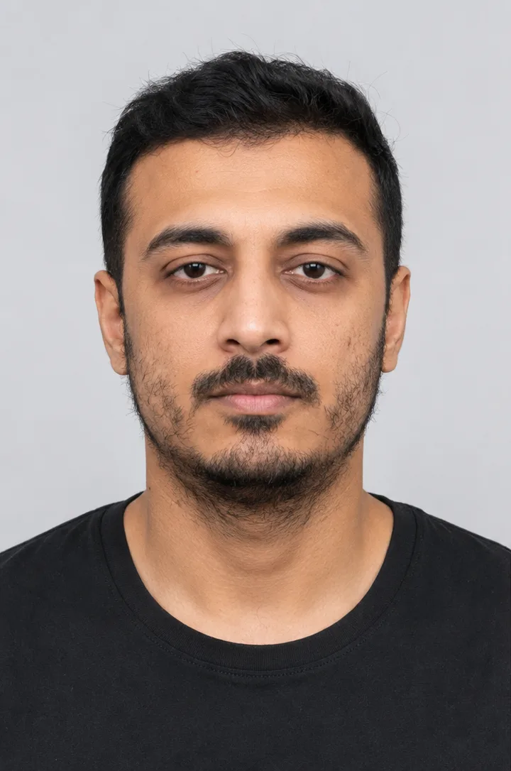 Beard transplant in Istanbul — patient photo before treatment
