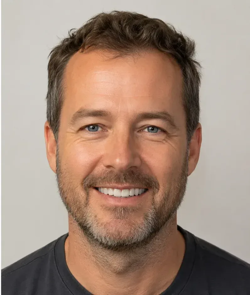 Dental implants in Istanbul — patient smile after treatment