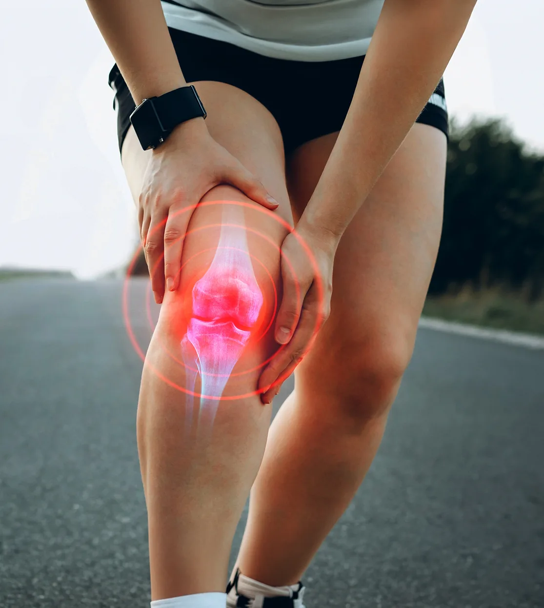 Total Knee Replacement